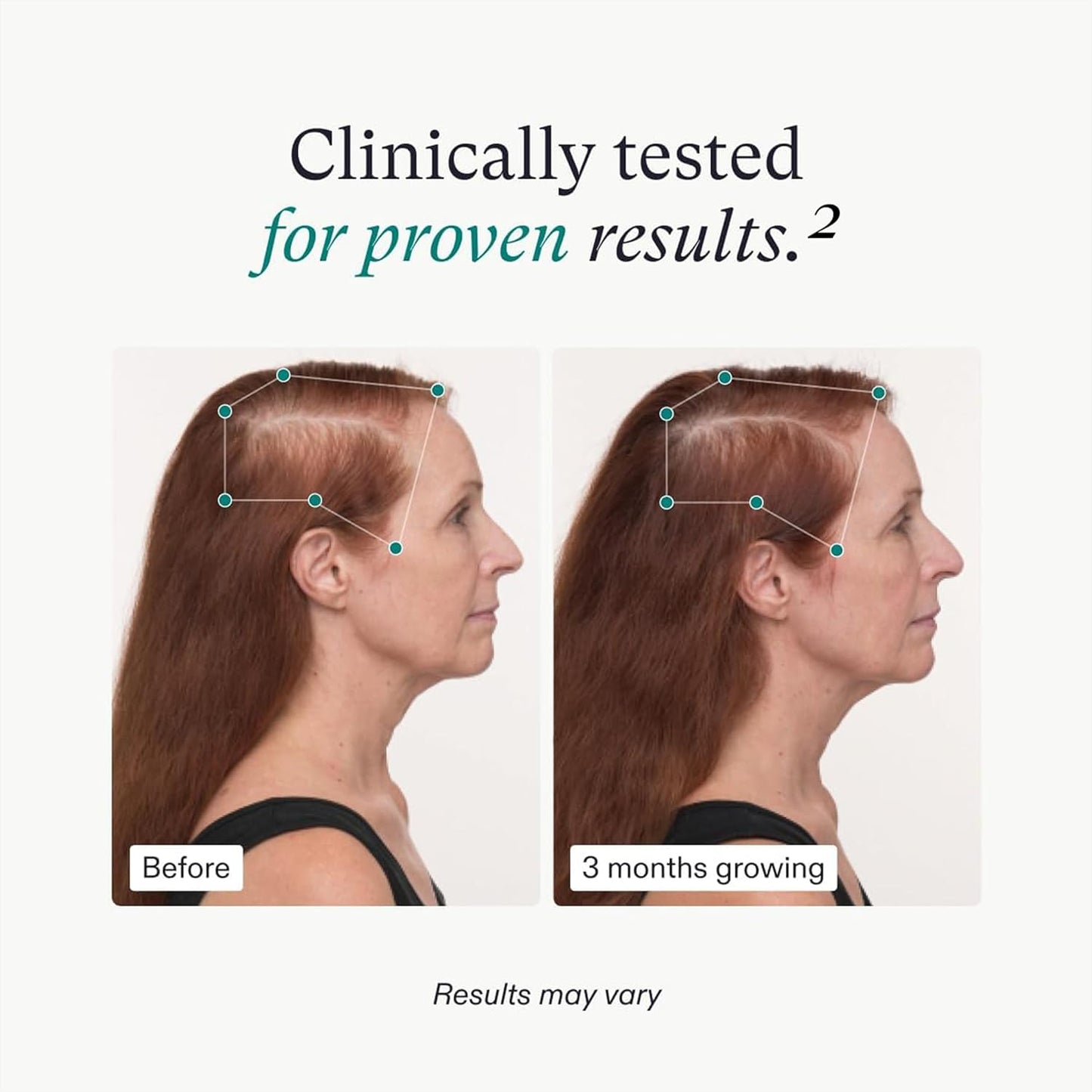 Nutrafol Women's Balance Hair Growth Supplements, Dermatologist Recommended - 1 Month Supply